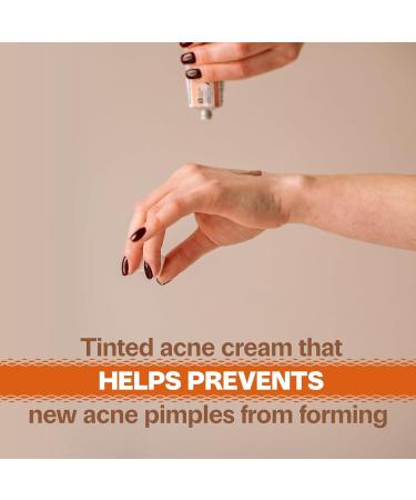 Adult Acnomel Acne Medication Cream 1.3oz - Fast-Acting Acne Treatment for Clear Skin - Buy Online on SooperMarket.com