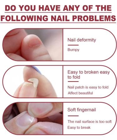 Instant Nail Repair Gel - Nail Strengthener and Hardener for Broken Nails - 8ml - Buy Online on SooperMarket.com