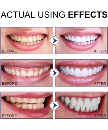 Aiposhiy Teeth Whitening Powder - Probiotic Mint Tooth Cleaning Powder for Spot Removal (2PCs) | Effective Whitening Solution - Buy Online on SooperMarket.com