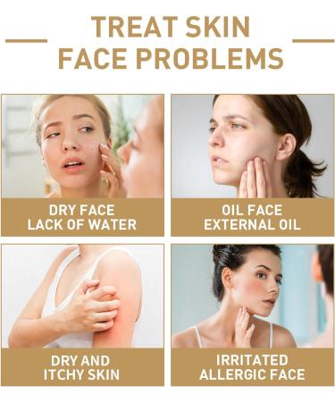 Rice Toner 150ML Smoothing Pore Minimizer & Moisturising Facial Toner - Niacinamide Essence for Dry Skin - Redness & Exfoliating - 1pc - Buy Online on SooperMarket.com