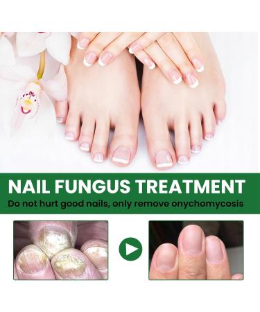 MrCuvaryas Nail Serum for Toenails Extra Strong - Buy Online on SooperMarket.com