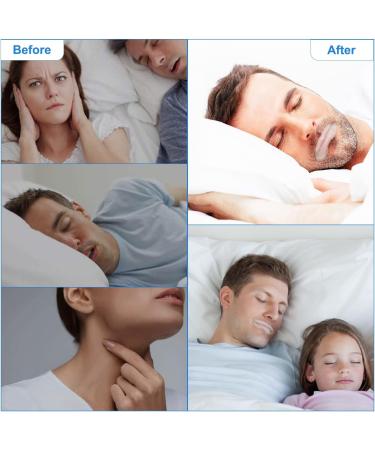 Mouth Tape for Sleeping 90 Pcs - Snoring Solution Sleep Strips for Better Nose Breathing and Instant Snoring Relief - Buy Online on SooperMarket.com