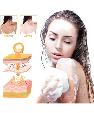 Nmbol Soap Cleansing Kojic Acid 3 - Buy Online on SooperMarket.com