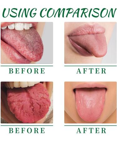 Portable Tongue Repair Spray - Relieve Bad Breath Swelling & Pain | Pack of 3 - pH Neutral & Effective Cleaning - Buy Online on SooperMarket.com