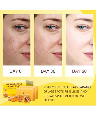 Organic Turmeric Kojic Acid Soap - 200g Brightening Bar for Hyperpigmentation Dark Spots & Acne - 7OZ Natural Hand & Body Wash - Buy Online on SooperMarket.com