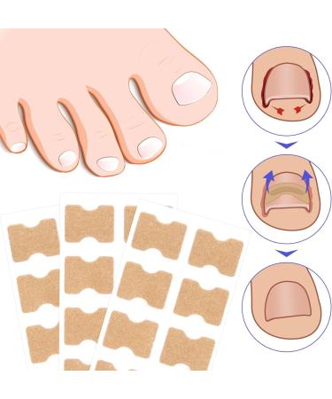Toen il Correction Sticker 100Pcs: N il Repair P tches Restores Appearance of Discolored or Damaged Nails Foot Care - Buy Online on SooperMarket.com