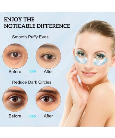 ProChosen Collagen Under Eye Patches - Anti-Aging Mask for Eye & Lip, Hydrating Skincare with Blueberries - 30 pairs - Buy Online on SooperMarket.com