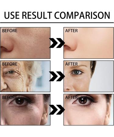 Serum Instant Effect Face Face Serum Plumping Skin Hydrating Serum Instant Face Tightening Facial Essence Anti-Aging Serum Skin Lightening Serum Dark Eye Circle Wrinkle Remover - Buy Online on SooperMarket.com