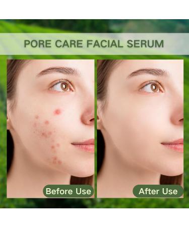 Tea Tree Face Serum - Tea Tree Oil Hyaluronic Acid Serum Dark Spot Correcting Glow Serum Korean Serum Tea Tree Cream Skin Brightening Hydrating Serum For All Skin Types 30ml - Buy Online on SooperMarket.com
