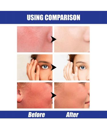 Centella Sunscreen SPF 50 PA++++ Calming Moisture Daily Sunscreen SPF 50 Centella Water-Fit Sun Serum Korean Sunscreen with No White Cast Sunscreen Korean Skincare for UV Defense Non-Greasy Sun Cream - Buy Online on SooperMarket.com