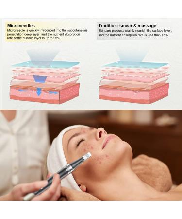 Pelcas Rechargeable Car Derma Micro Needles Roller - Electric Anti-Aging Skin Therapy Pen with 3 Speed Levels 12 Needle Heads for Stretch Marks Acne Scars & Fine Lines - Buy Online on SooperMarket.com