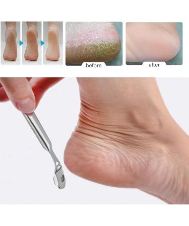 Foot Care Tool Kit with Foot Scrubber Scraper Foot Care Tools for Perfect Foot Care and Pedicure Foot Rasp Kit for Dead Hard Skin - Buy Online on SooperMarket.com