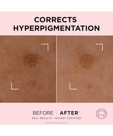 L'Oreal Paris Age Perfect Golden Age Rapid Spot Corrector for Mature Skin Niacinamide and Exclusive Peony Native Cells Reduces Appearance of Dark Spots 50ml - Buy Online on SooperMarket.com