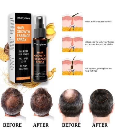 Trendyfave Hair Regrowth Spray Hair Growth Serum Thickening Hair Volume Spray Anti Hair Loss Spray Hair Rapid Growth Spray Natural Ingredients Hair Regrowth Serum Repair Hair Follicles -30ML - Buy Online on SooperMarket.com