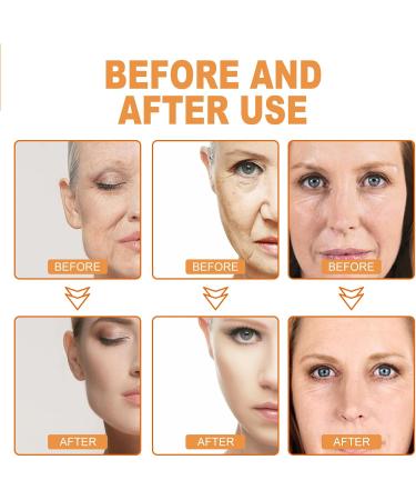 KOAHDE Anti Aging Soft Face Cream Wild Yam Moisturizing Face Cream Moisturizing Anti Wrinkle Cream Wild Yam Collagen Moisturizing Cream Wild Yam Whitening Moisturizing Cream Wild Yam Anti Aging Cream - Buy Online on SooperMarket.com
