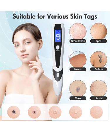 Aceshop Skin Tags Removal Pen Professional Mole Remover Pen Kit with 9 Strength Levels & Replaceable Needles USB Rechargeable Mole Remover Pen Kit Plasma Pen for Wart Freckle Nevus (White) - Buy Online on SooperMarket.com