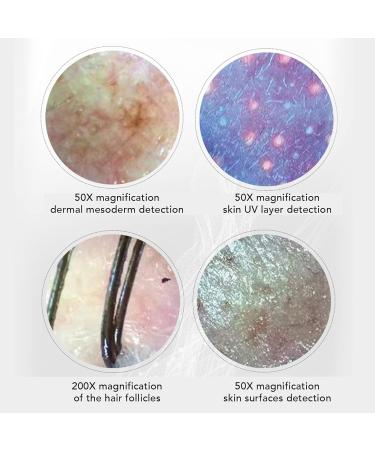Skin Diagnosis Hair Analyzer 17 Inch 50X 200X Magnification LCD Screen Scalp Hair Follicle Hair Skin Analyser Machine 3 Light Modes Hair Follicle Detector for Home Salon Use - Buy Online on SooperMarket.com
