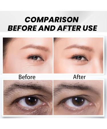 Anti Wrinkle Eye Cream Anti Aging Under Eye Cream for Dark Circles Puffy Eyes Instant Tightening Hydrating and Firming Eye Serum Creams Eye Repair Cream Anti-Aging Eye Care for All Skin Types - Buy Online on SooperMarket.com