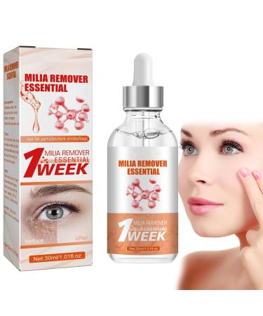 Speedy Milia Remover Milia Remover Milia Remover Under Eyes Milia Spot Serum for Face Helps Dissolve and Reduce Milia Dark Spot Remover to Reduce Milia Dark Circles Under Eye for Women & Men