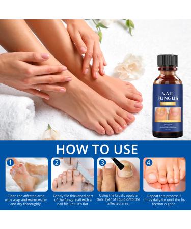 Extra Strength Toe Nail Fungus Treatment - Effective Nail Repair Solution for Healthy Nails - Buy Online on SooperMarket.com