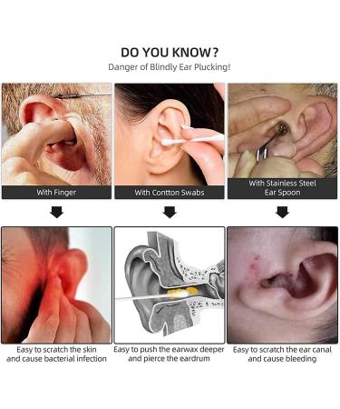 Jteremy Smart Ear Wax Removal Tool | 5M Pixel HD WiFi Endoscope | Otoscope Ear Cleaner - Buy Online on SooperMarket.com