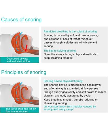 KUIKUI Anti-Snoring Device - Advanced Sleep Aid Technology - Buy Online on SooperMarket.com