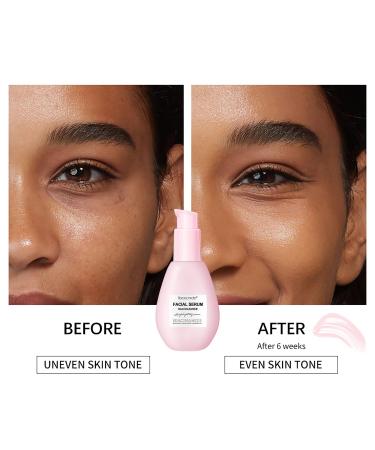Brightening Watermelon Serum | Hydrating Glow Dew with Hyaluronic Acid & Vitamin E for Even Skin Tone | 60ml Facial Serum for Dark Spots & Smooth Skin - Buy Online on SooperMarket.com