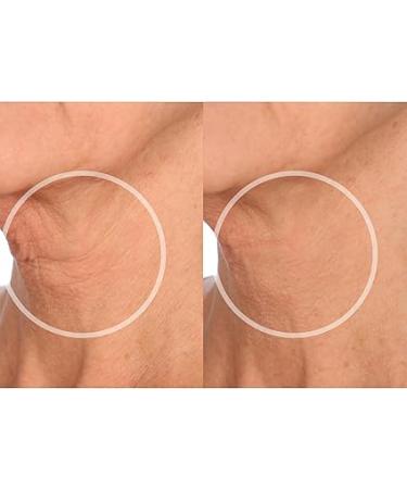 SiO Beauty NeckLift | Overnight Anti-Wrinkle Silicone Patches | Smooth Neck Wrinkles and Fine Lines - Buy Online on SooperMarket.com