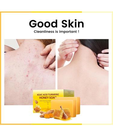 Organic Turmeric Kojic Acid Soap - 200g Brightening Bar for Hyperpigmentation Dark Spots & Acne - 7OZ Natural Hand & Body Wash - Buy Online on SooperMarket.com