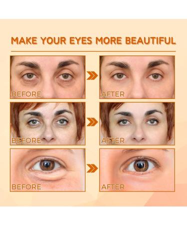Honey Polypeptide Eye Cream Eye Cream Anti Aging For Puffy Eyes Reduce Wrinkles And Fine Lines Korean Eye Cream For Eye Bags & Dark Circles Moisture Hydrate Smooth Tender Sensitive Skin - Buy Online on SooperMarket.com
