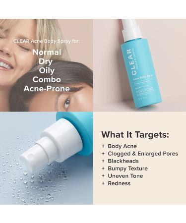 Paula's Choice CLEAR Back and Body Acne Spray - 2% Salicylic Acid Treatment - 4 oz - Buy Online on SooperMarket.com