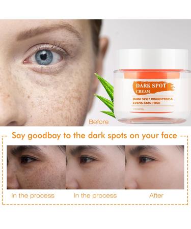 Dark Spot Remover for Face & Body - Niacinamide Aloe Vitamin E | Even Skin Tone Cream 1.76OZ - Buy Online on SooperMarket.com