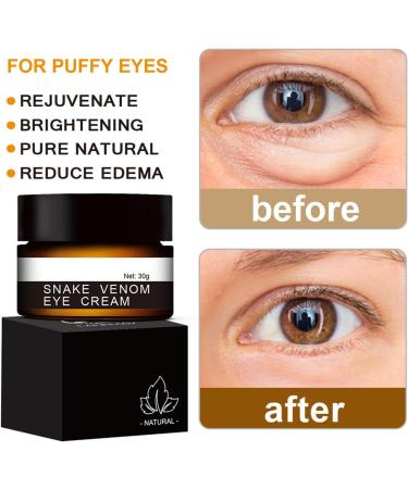 Snake Venom Eye Cream - Anti Wrinkle Eye Cream For Puffiness + Wrinkles Brightening Under Eye Cream Diminishing Deep Wrinkles Dark Circle Eye Cream Eye Bag Treatment For Men And Women 30g - Buy Online on SooperMarket.com