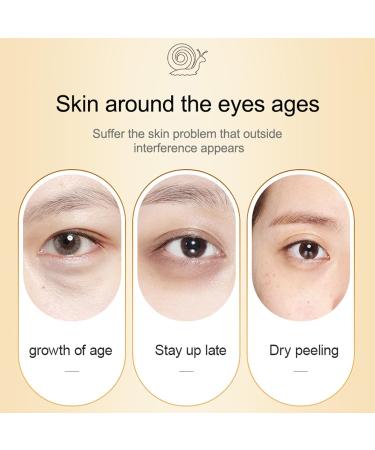 Snail Essence Eye Cream Moisturise Nourise Eye Serum Anti Aging Snail Mucus Eye Cream For Dark Circles Eye Skin Firming Mens & Women Eye Cream Reduces Fine Lines Eye Bags - Buy Online on SooperMarket.com