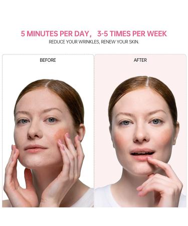 USUIE 4 in 1 Facial Wand - Red Light Therapy Facial Massager for Face and Neck - Reduce Wrinkles & Anti-Aging Tools - Pink - Buy Online on SooperMarket.com