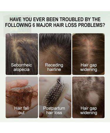 Trendyfave Ginger Hair Growth Cream Hair Cream for Hair Regrowth Natural Herbal Ginger Extract Hair Serum Nourishing Scalp Hair Care Hair Boost Cream for Thinning/Balding/Repairs Hair Follicles - Buy Online on SooperMarket.com