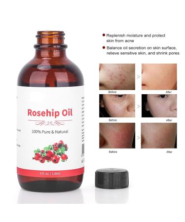 Rosehip Oil 118 ml - Natural Anti-Aging Moisturizing Massage & Spa Essential Oil for Aromatherapy - Buy Online on SooperMarket.com