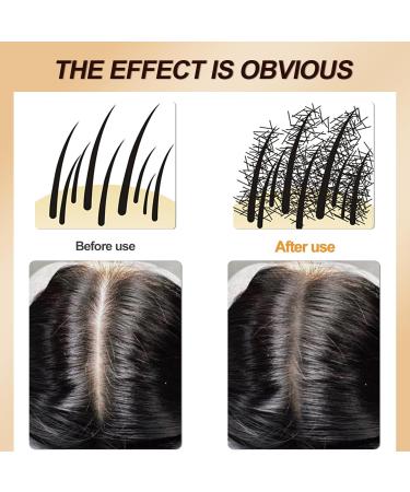 Sularpek Hairline Powder Hairline Powder Instantly Conceals Hair Loss Hairline Shadow Powder for Thinning Hair for Women and Men Bald Spots Eyebrows Beard Line Dark Brown - Buy Online on SooperMarket.com