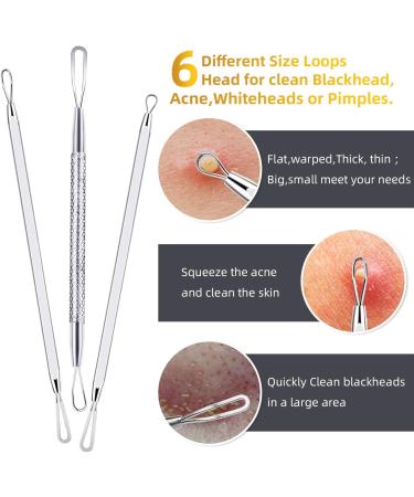 Aibee 10pcs Blackhead Remover Set - Stainless Steel Comedone Squeezer & Pimple Tweezers for Facial & Acne Care - Best Blackhead Removal Tools - Buy Online on SooperMarket.com