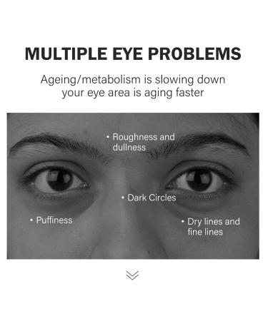 Avocado Retinol Eye Cream | Dark Circles Treatment & Anti-Aging Moisturizer | Firming Under Eye Cream for All Skin Types (15g - Buy Online on SooperMarket.com