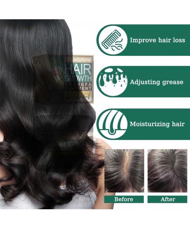 Trendyfave Ginger Hair Growth Cream Hair Cream for Hair Regrowth Natural Herbal Ginger Extract Hair Serum Nourishing Scalp Hair Care Hair Boost Cream for Thinning/Balding/Repairs Hair Follicles - Buy Online on SooperMarket.com
