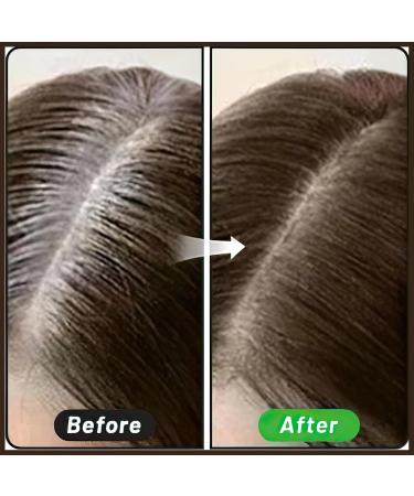 MIELIKKI Hairline Concealer Powder - Instantly Conceal Hair Loss & Thin Hair for Men & Women Stain-Proof Formula Brown 03 - Buy Online on SooperMarket.com