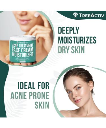 TreeActiv Acne Treatment Face Cream with Salicylic Acid & Tea Tree Oil - 90 Day Supply - Buy Online on SooperMarket.com