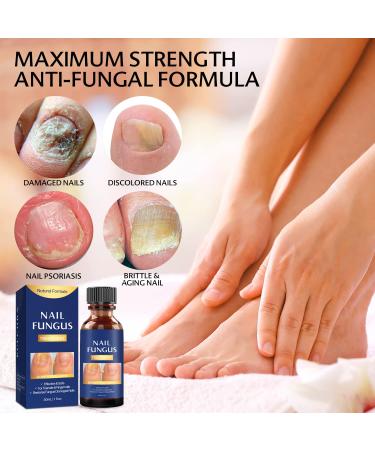 Extra Strength Toe Nail Fungus Treatment - Effective Nail Repair Solution for Healthy Nails - Buy Online on SooperMarket.com
