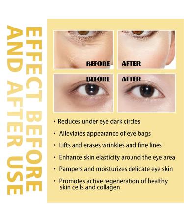 Rollerball Castor Oil & Frankincense Eye Roller | Reduce Dark Circles & Bags Under Eyes - International Shipping - Buy Online on SooperMarket.com