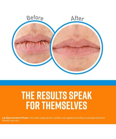 O'Keeffe's Cooling Relief Lip Repair Balm for Dry, Cracked Lips - 0.35 oz Tube - Buy Online on SooperMarket.com