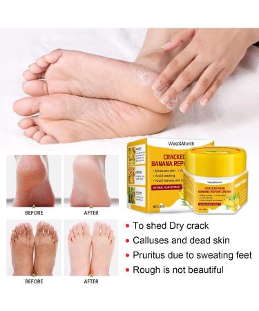 Shea Butter Foot Cream for Very Dry Feet & Cracked Heels - Effective Ointment for Soft Skin | A Size - Buy Online on SooperMarket.com