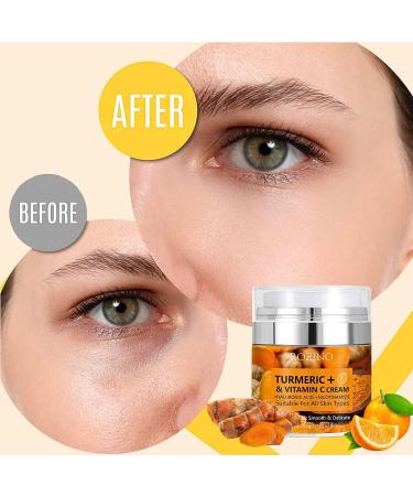 Vitamin C + Turmeric Face Cream Vitamin C Face Moisturiser Anti Aging Face Cream Brightening Night & Day Cream Dark Spot Remover for Face & Body Moisturizing & Smooth & Delicate Skin - Buy Online on SooperMarket.com