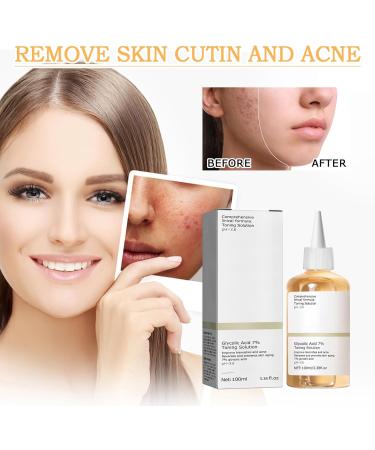 Glycolic Acid Toner Glycolic Acid Peeling 7% Glycolic Acid Toning Resurfacing Glycolic Acid Peeling Toner Toning Solution Glycolic Acid 7% Toner Peeling Toner for Body Face Skin with Dark Spots-240ml - Buy Online on SooperMarket.com