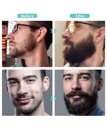 Beard Growth Kit with Derma Roller, Oil, Balm, Comb - Perfect Gift for Men - Fathers Gifts for Dad - Buy Online on SooperMarket.com